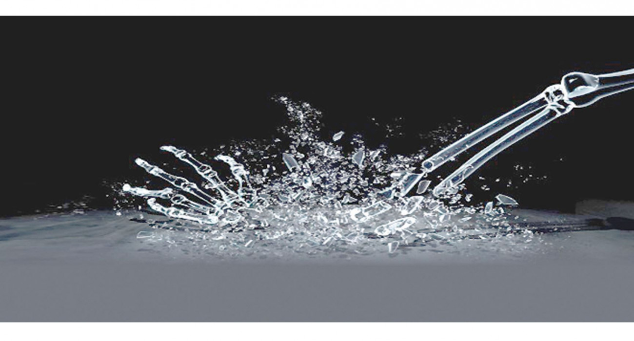 Перзентханада босанып жатқан киска суреті