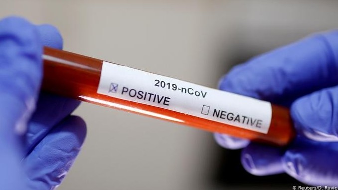 Атырауда 700-ге жуық экспресс-тест бар