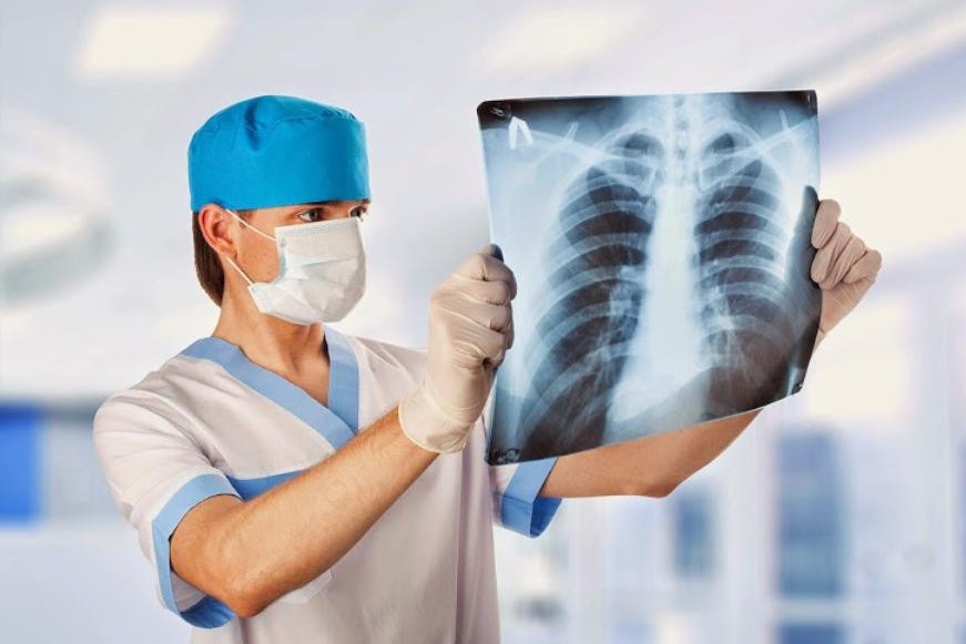 ДДСҰ: COVID-19 вирусымен күрес кезінде туберкулезге қарсы шаралар күшейтілуі қажет