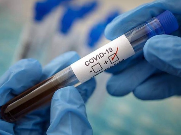 Шымкентте тағы бір азамат коронавирус жұқтырған