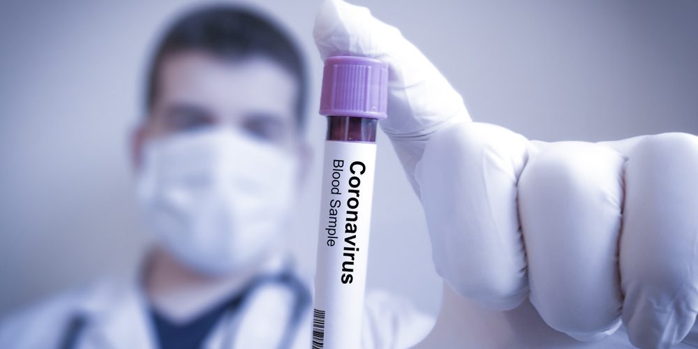 Жамбыл облысында коронавирус инфекциясының алты жаңа дерегі анықталды