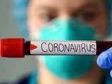 Өткен тәулікте 31 адам коронавирус жұқтырды