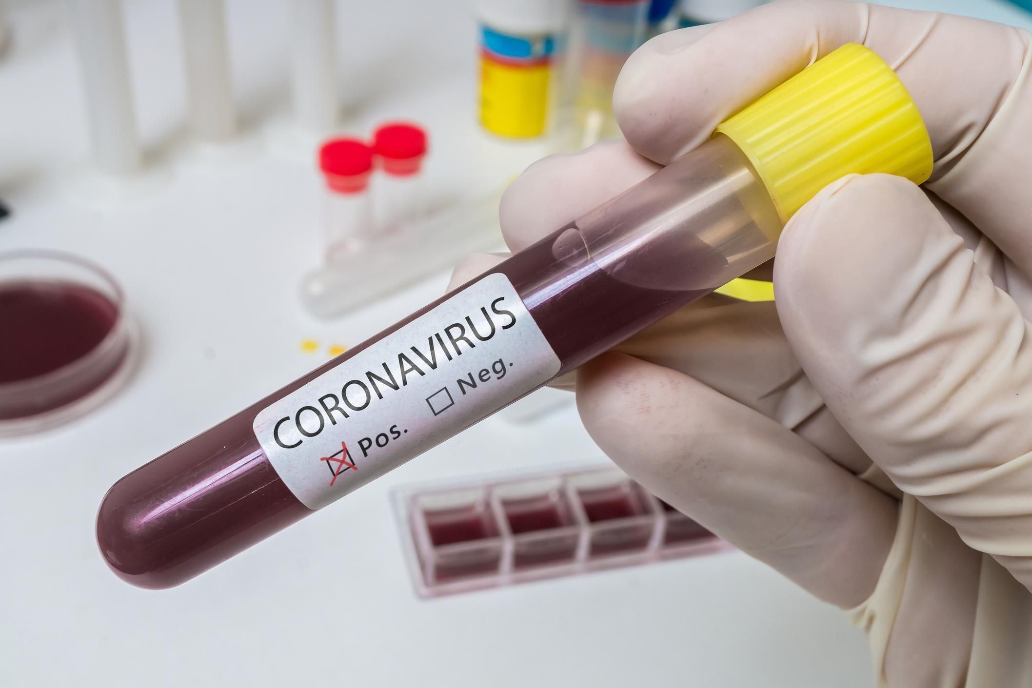 4 адам коронавирус індетінен емделіп шықты