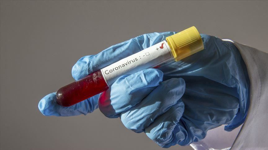 Қазақстанда коронавирус инфекциясын жұқтырған тағы 18 адам тіркелді