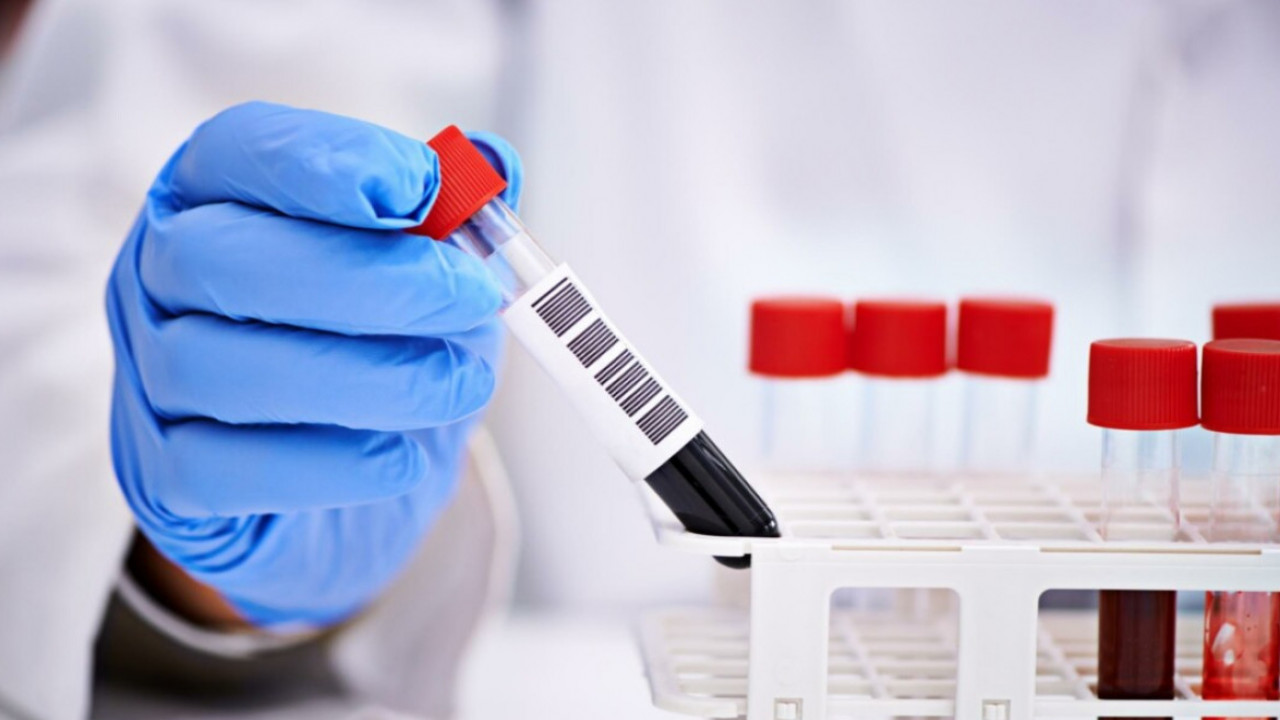 Екібастұздың электр стансаларында COVID-19 анықталды