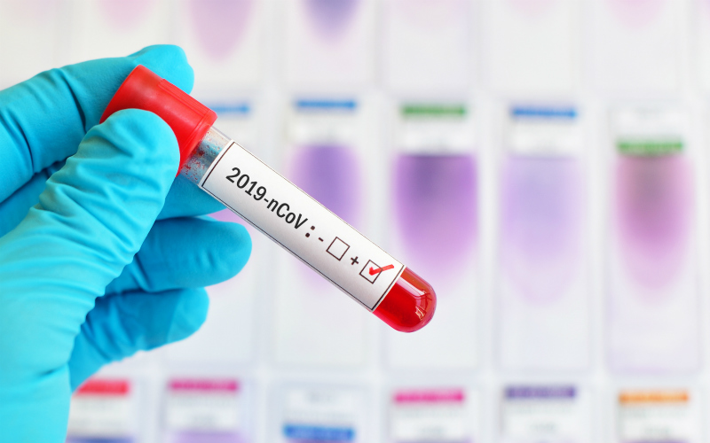 Қазақстанда коронавирус жұқтырған тағы 43 адам тіркелді