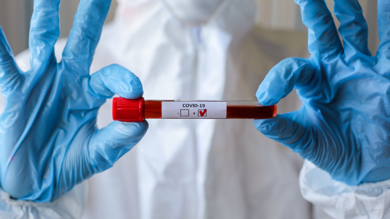 Қызылорда: 6 медицина саласының қызметкері вирус жұқтырды