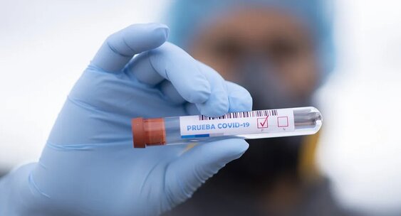 2791 науқас: Коронавирус инфекциясын жұқтырған тағы 11 адам тіркелді