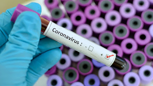 3 078 науқас: Елімізде коронавирус инфекциясын жұқтырған тағы 15 адам тіркелді