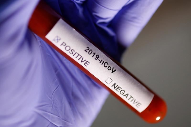 Шымкентте тағы 4 адам коронавирус инфекциясын жұқтырған