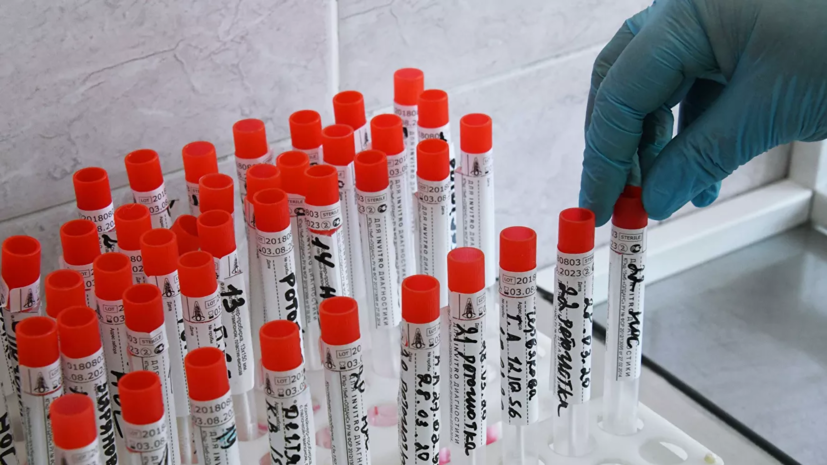 Ресейде соңғы тәулікте 10 мыңнан астам коронавирус инфекциясы анықталды
