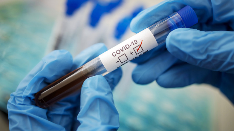 Шымкентте коронавирус инфекциясын жұқтырған 6 адам тіркелді