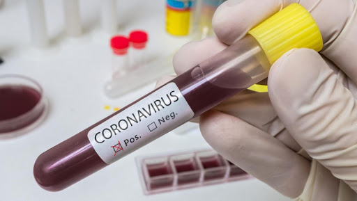 4 530 науқас: Коронавирус инфекциясын жұқтырған тағы 21 адам тіркелді