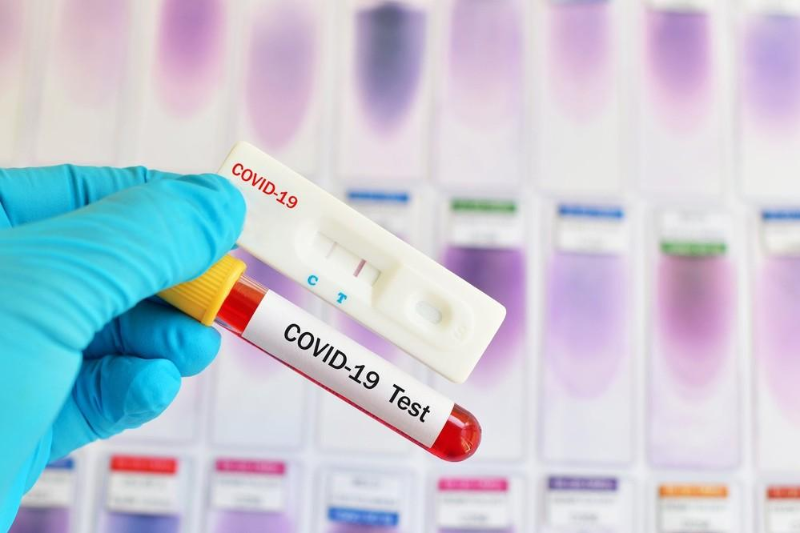 Маңғыстау облысында 4 адам коронавирус инфекциясын жұқтырды