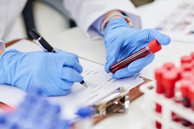 Шымкент қаласында коронавирус инфекциясын жұқтырған тағы 31 адам тіркелді