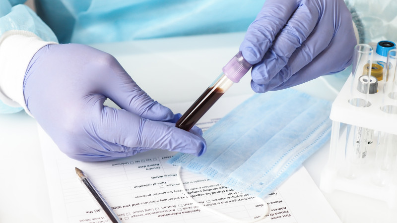 Елорданың Бас санитарлық дәрігері коронавирустың таралуының алдын алу жөніндегі қосымша шаралар жариялады