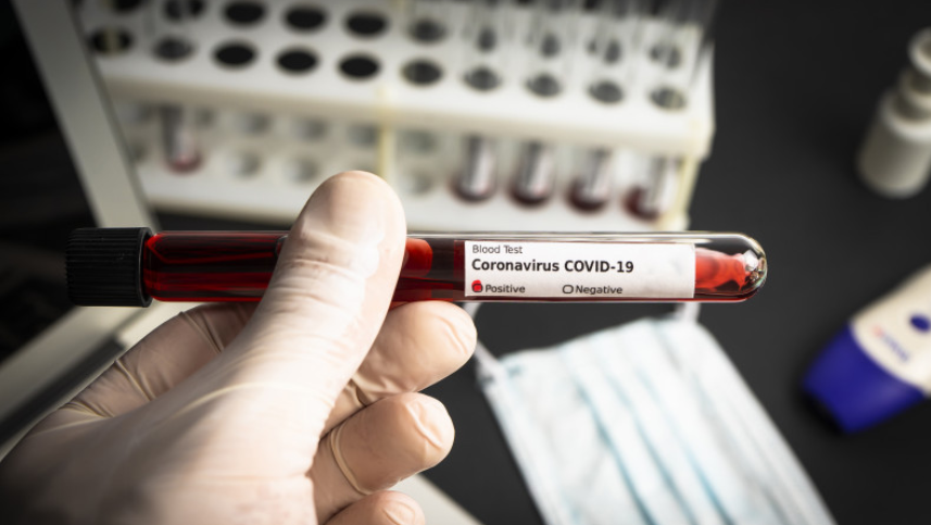 Атырау: Індет жұқтырғандар саны 1024 адамға жетті