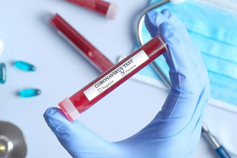 Қызылордада вирус жұқтырған 23 адам тіркелді