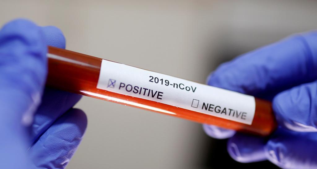 Маңғыстауда тегін экспресс-тесттен өтуге болады