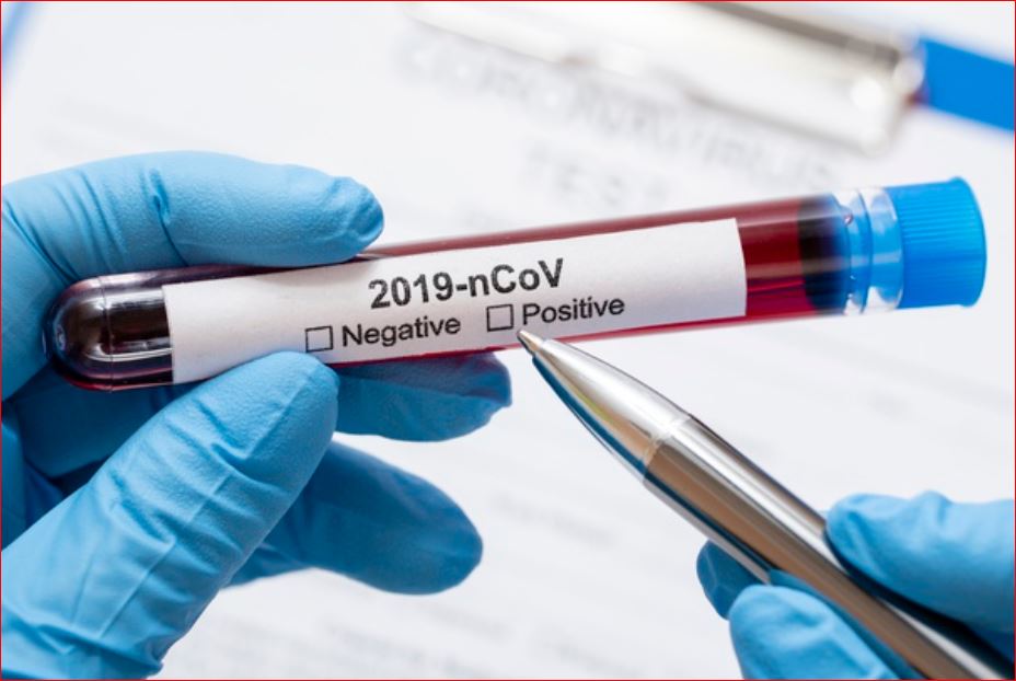 Covid-19: Қызылорда облысында 17 жаңа дерек тіркелді