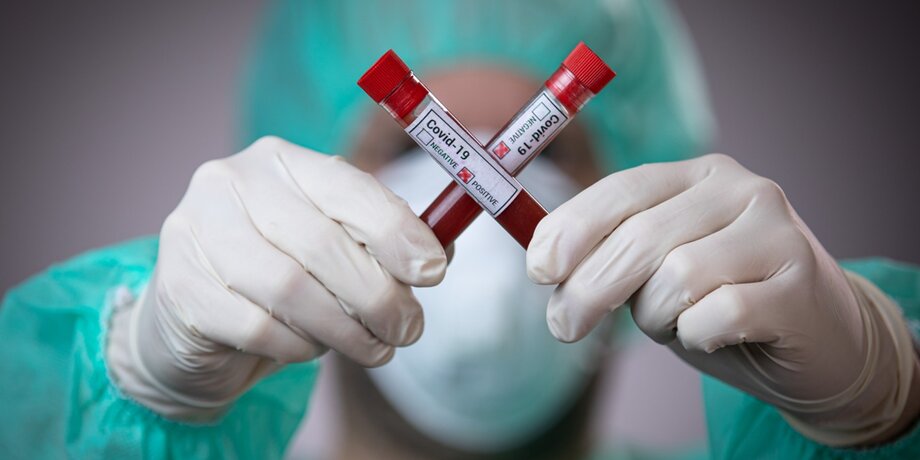 Шымкентте коронавирус індетін жұқтырған тағы 25 адам анықталды
