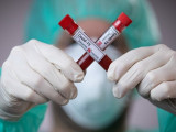 Шымкентте коронавирус індетін жұқтырған тағы 25 адам анықталды