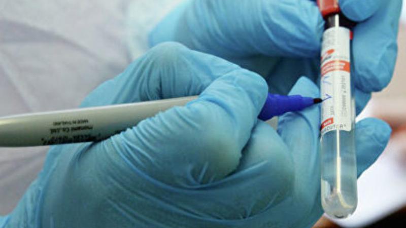 Онкологиялық науқастар арасында 168 адам вирус жұқтырған