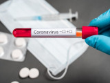 Өткен тәулікте коронавирус жұқтырған 741 адам тіркелді