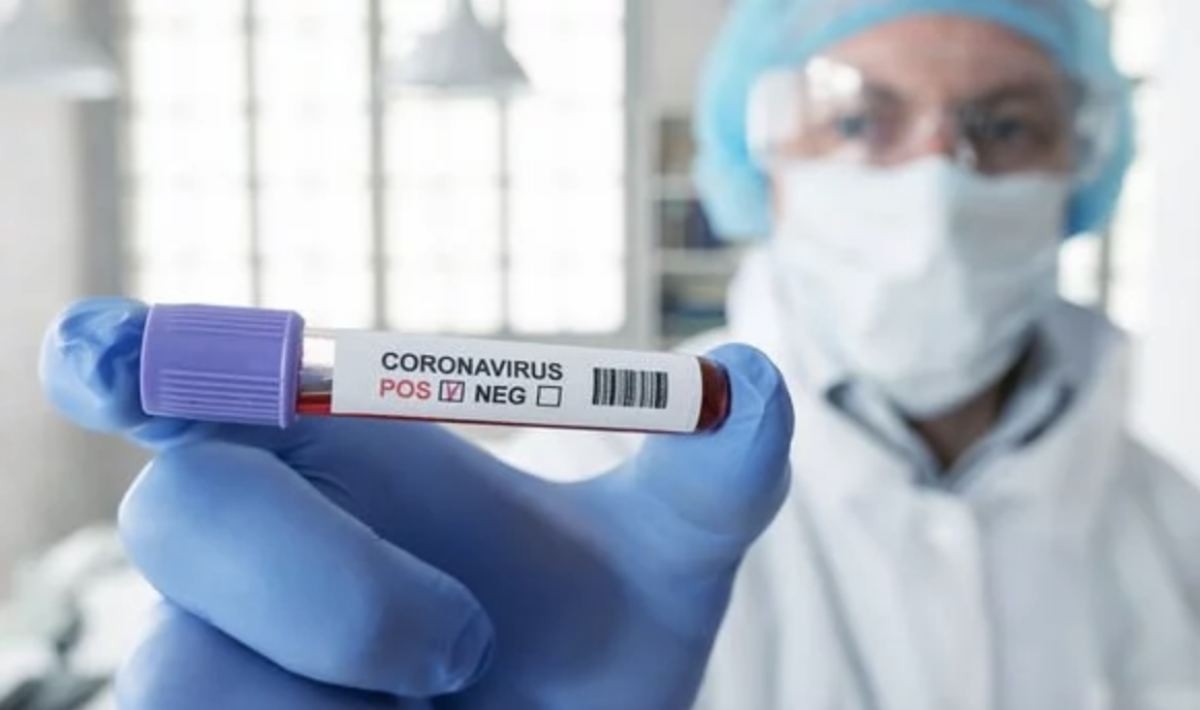 Қазақстанда өткен тәулікте 72 адам коронавирус індетімен ауырған