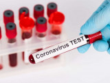 Қазақстанда бір тәулікте 142 адамнан коронавирус анықталды