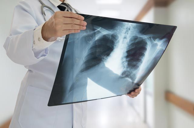 Коронавирус жұқтырған 119 адамның жағдайы нашар