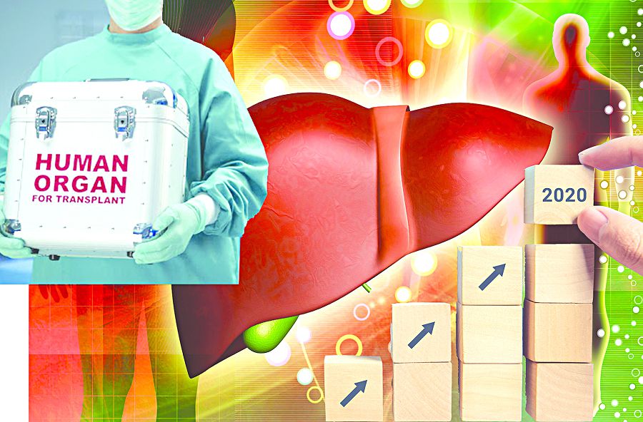 Трансплантология түйткілі (Ағза донорлығына мұқтаждар қатары артуда)