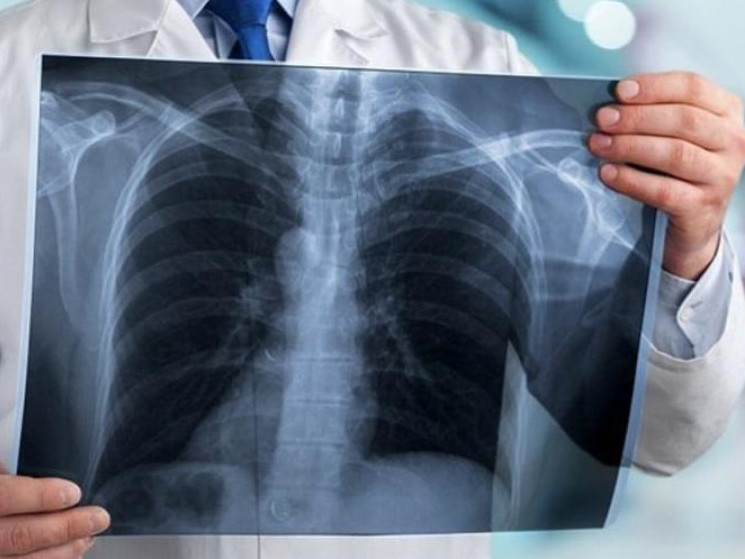 Қазақстанда бір тәулікте коронавирустан тоғыз адам қайтыс болды