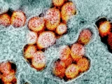 Нигериядағы вирусқа қарсы штамм патогендік өзгерістерге ұшырайды