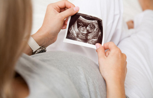 Атыраулық әйел жүктілігін дәрігерден жасырып келген