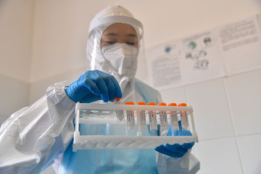 COVID-19-дан кейінгі асқынулар талқыланды