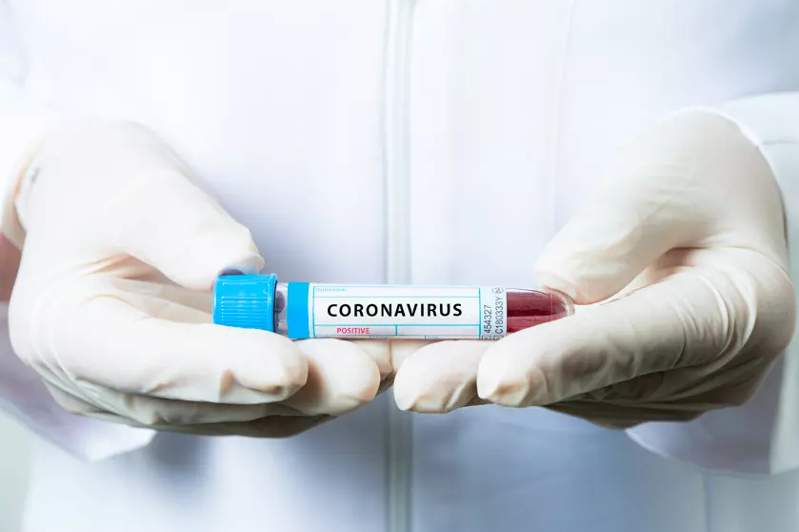 Қазақстанда бір күнде 2 мыңнан аса адамнан коронавирус анықталды