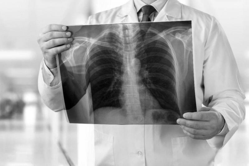 Коронавирус пневмониясынан 7 адам қайтыс болды