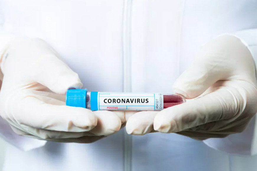 Қазақстанда бір күнде 7 803 адамнан коронавирус анықталды