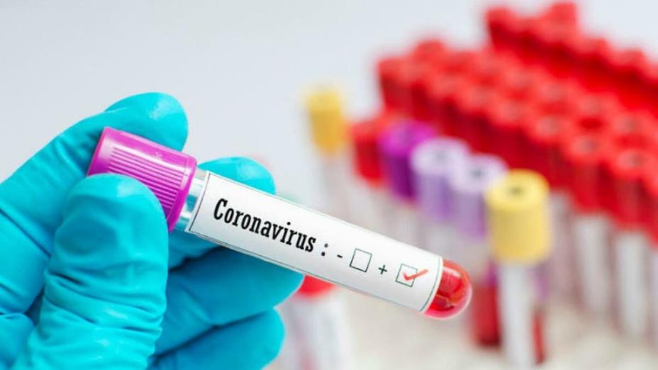 Өткен тәулікте елімізде 1700-ден астам адамнан коронавирус анықталды