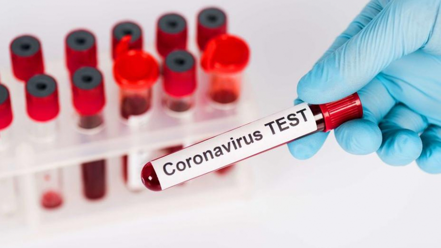 Қазақстанда мыңнан астам коронавирус анықталды