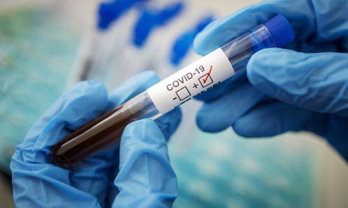 Өткен тәулікте 141 адам коронавирус инфекциясын жұқтырды
