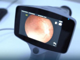 Диабеттік ретинопатияны анықтауға арналған бірегей жоба әзірленді