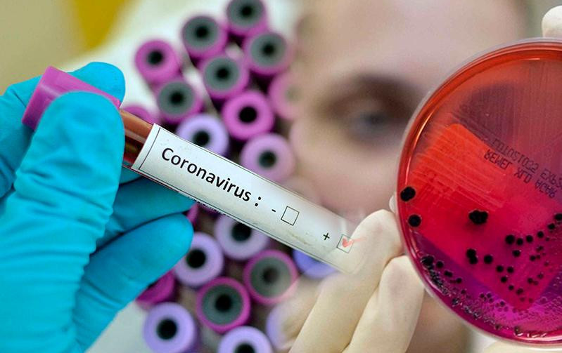 Өткен тәулікте 13 адамнан коронавирус анықталды