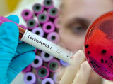 Өткен тәулікте 13 адамнан коронавирус анықталды