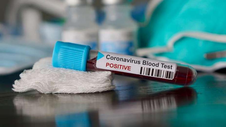 Өткен тәулікте 100 адамнан коронавирус анықталған
