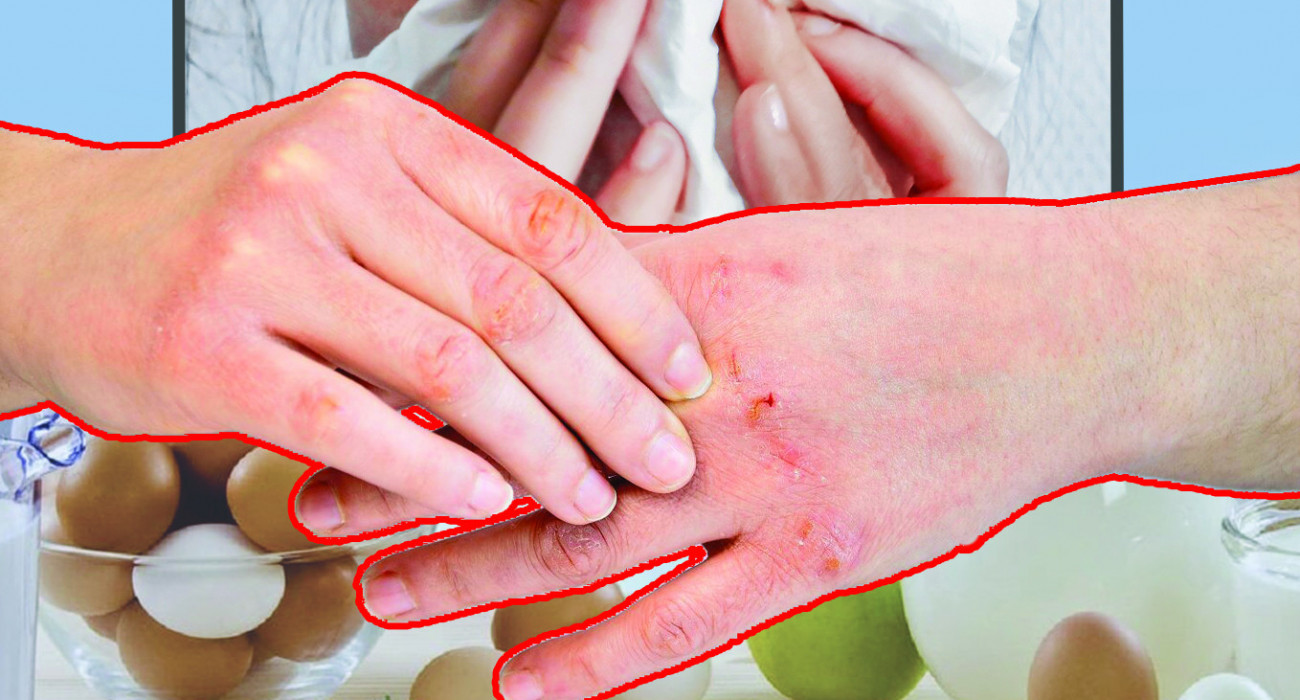 Ер адамның өз ұрығына аллергиясы болуы мүмкін.