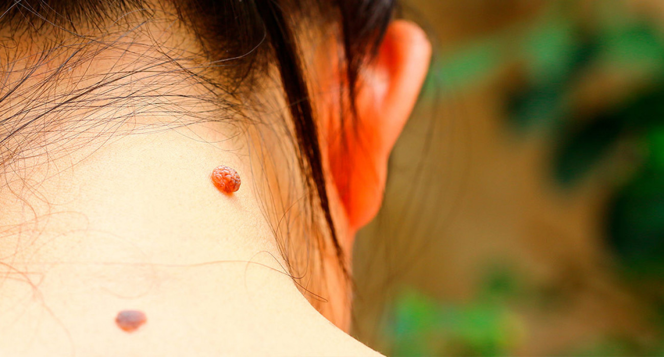 Ануста қалың дилдоның фотосы