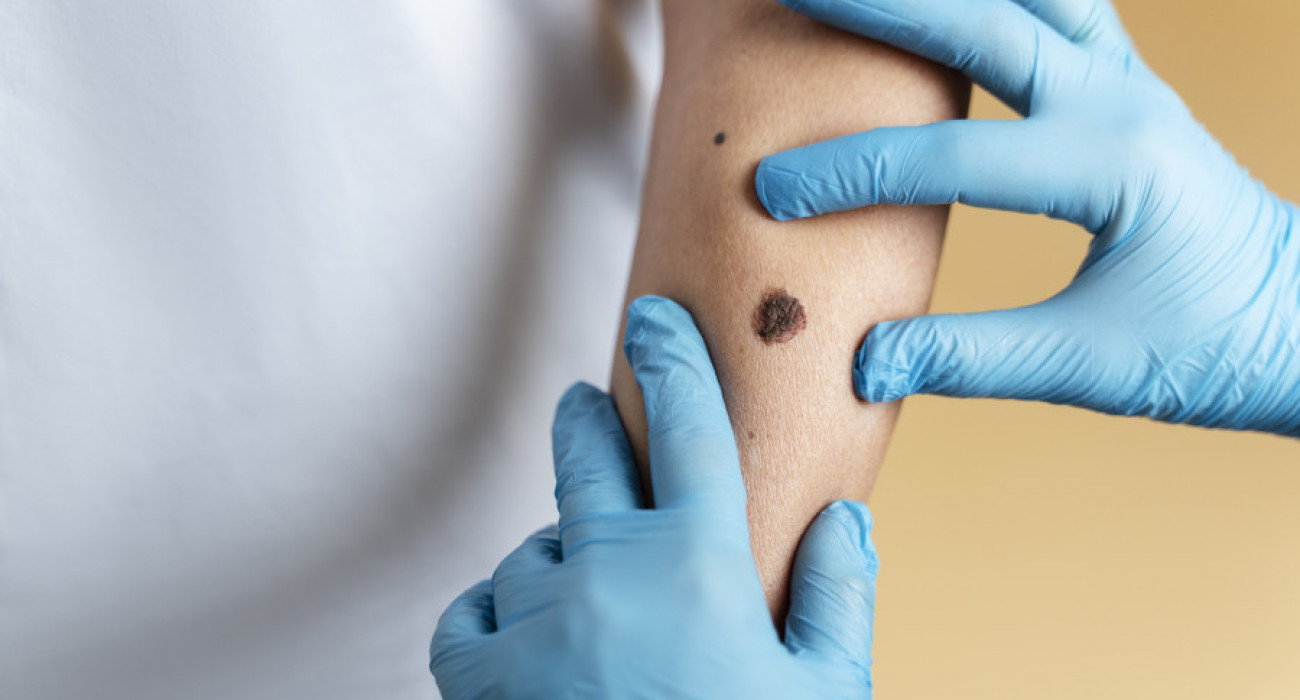 Ивано франкивск секс