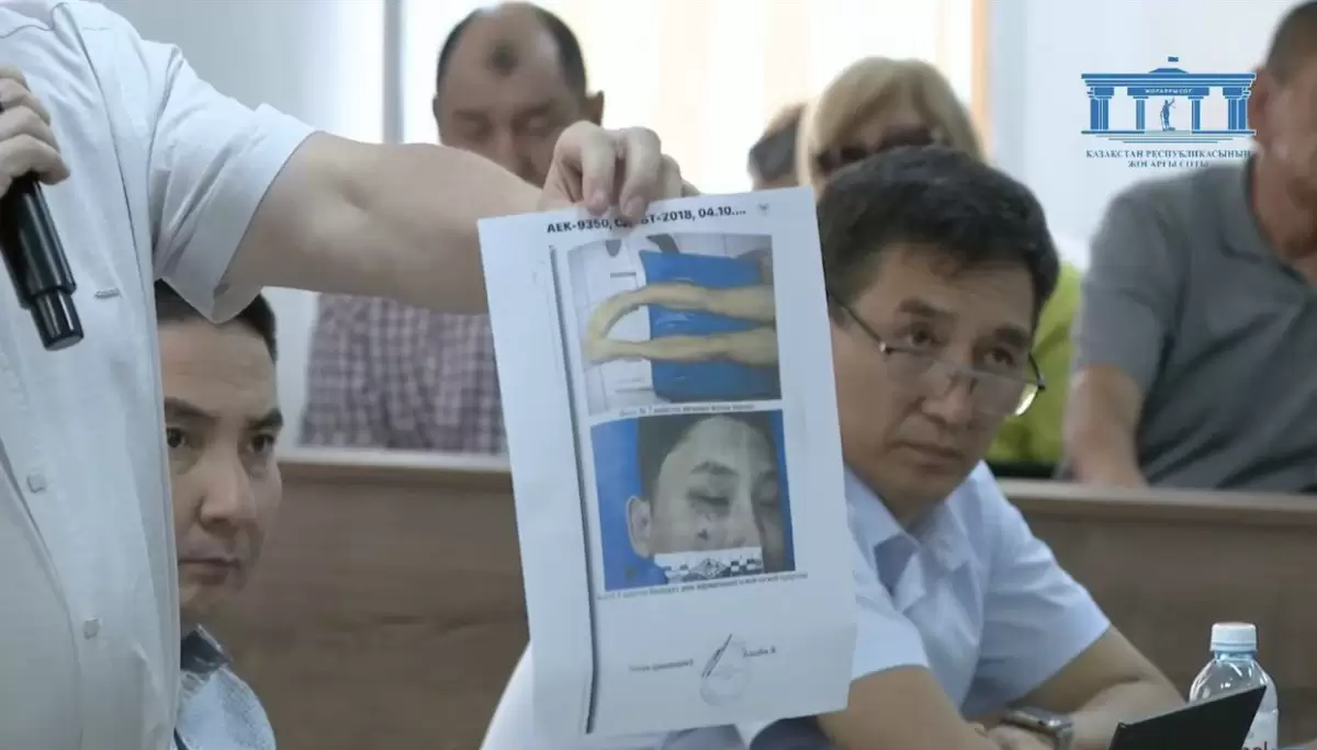 Шерзат ісі: мәйітке жасалған зерттеу